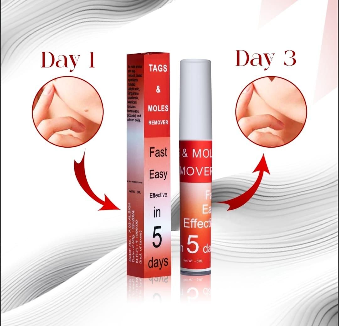 Tags & Moles Remover4.8⭐️⭐️⭐️⭐️⭐️ (83) rating